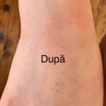 5 Beneficii ale utilizarii cremei cu uree pentru piele