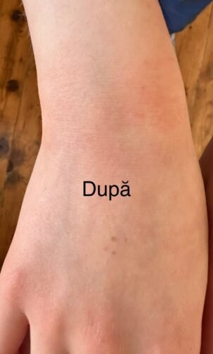 crema de maini cu uree si vitamina e