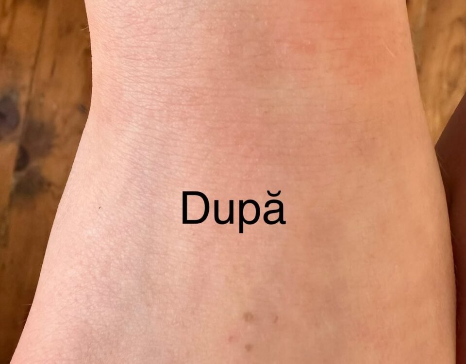 5 Beneficii ale utilizarii cremei cu uree pentru piele