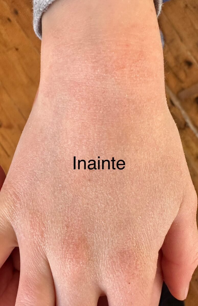 5 Beneficii  ale utilizarii unei creme cu uree pentru piele.